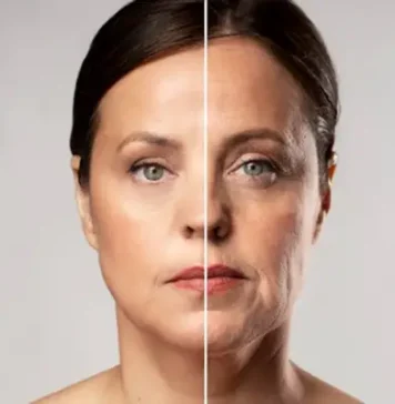 Peptidos para el Rostro: Cuales Son, Que Son, Para Que Sirven, Inyectables